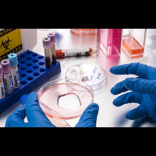 [0494-0568-001] E. Coli Recombinant Marburg Virus ''MARV'' matrix protein VP40   100ug