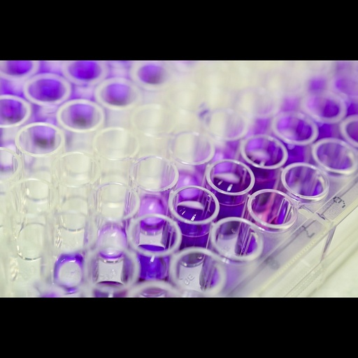 [0399-CSB-E11226h-96T] Human procollagen Ⅰ N terminal peptide,PⅠNP ELISA Assay 96 Tests